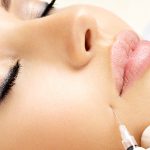Collagene, il trattamento iniettivo da alternare a Filler e Botox